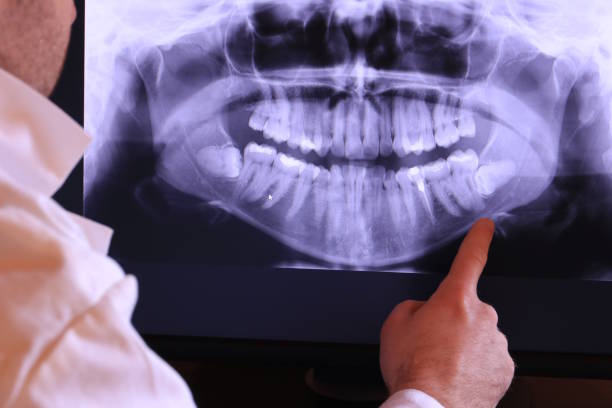 Best Emergency Root Canal Treatment in Georgiana, AL