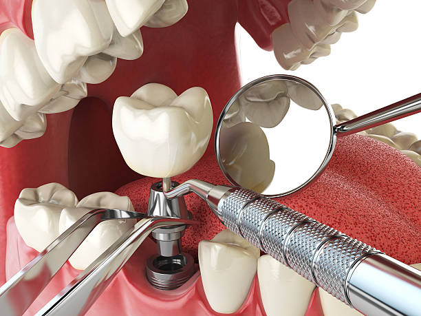 Best Emergency Dental Services for Seniors in Georgiana, AL
