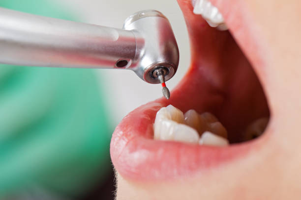 Best 24-Hour Emergency Dentist in Georgiana, AL